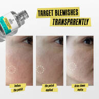 Kiehl's Truly Targeted Blemish-Clearing Solution