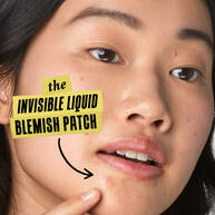 Kiehl's Truly Targeted Blemish-Clearing Solution